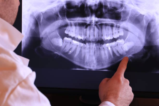 Best Emergency Broken Tooth Repair in Tipton, IA